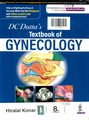 DC Durtt's Text book of Gynecology