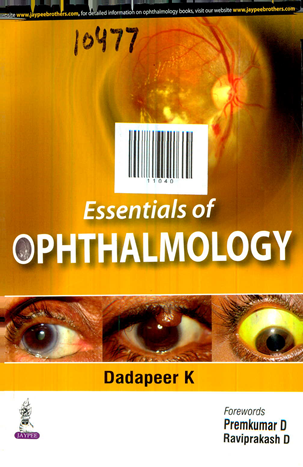 Essential of Ophthalmology
