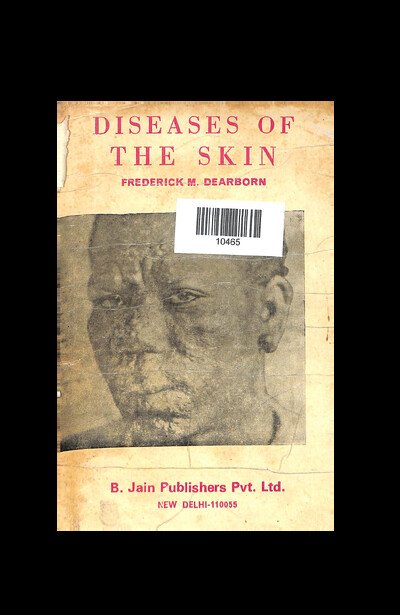 DISEASES OF THE SKIN FREDERICK M. DEARBORN