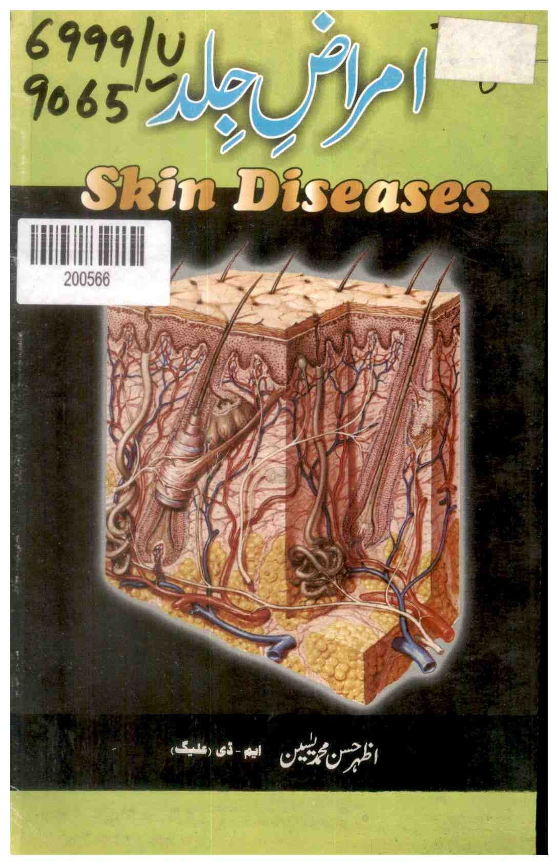 Skin Diseases