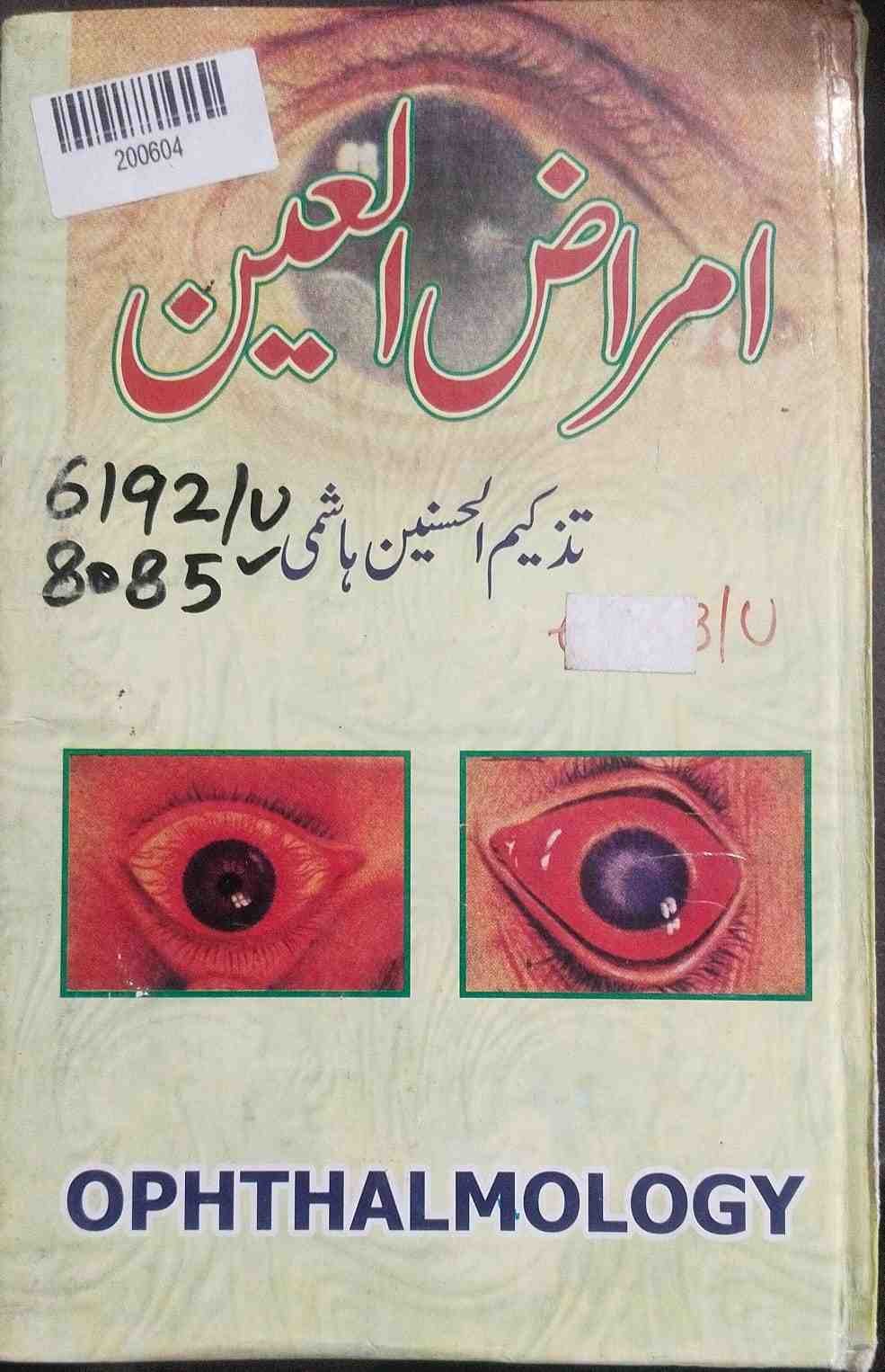 Diseases of the Eye