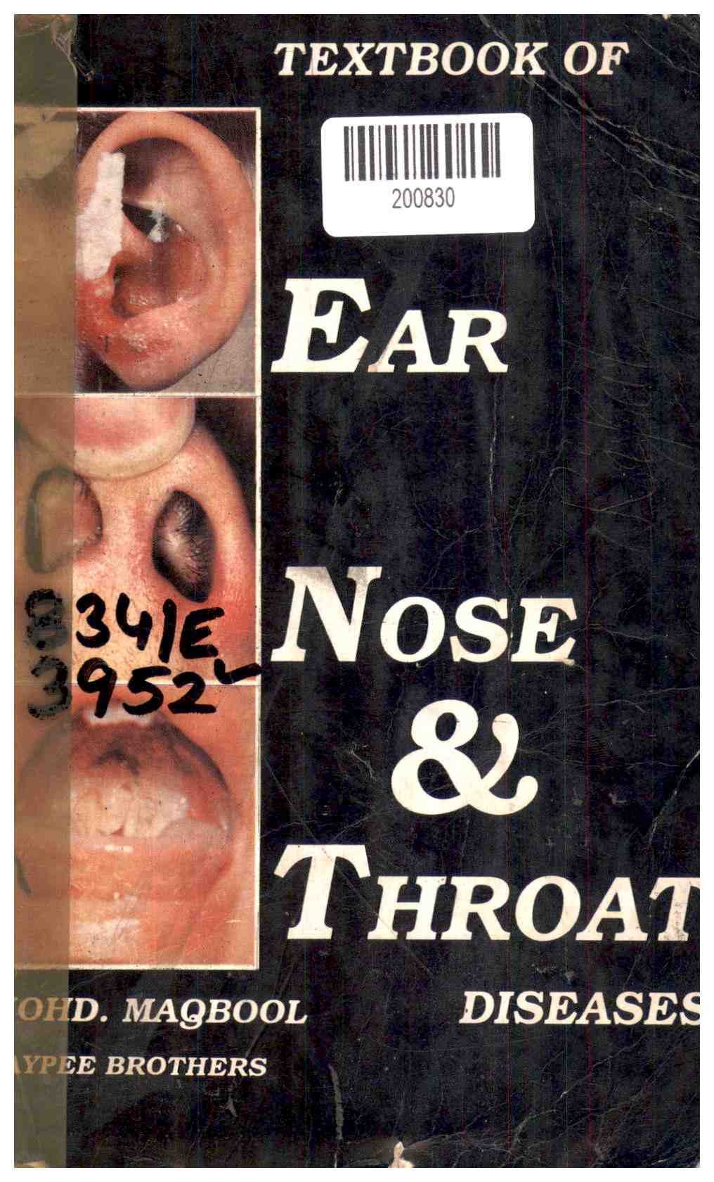 Textbook of Ear Nose & Throat Diseases