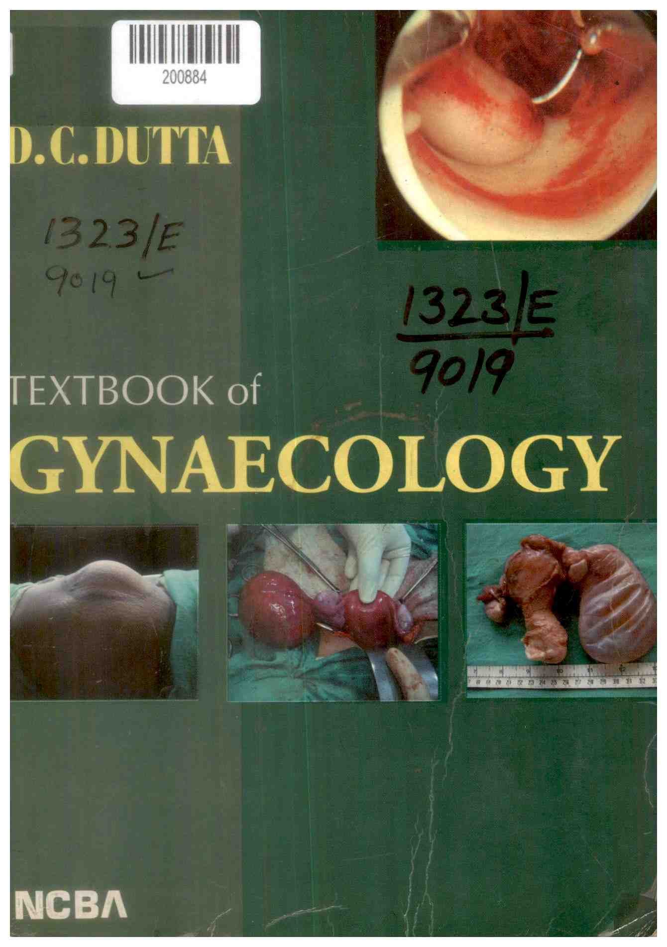 Textbook of Gynaecology